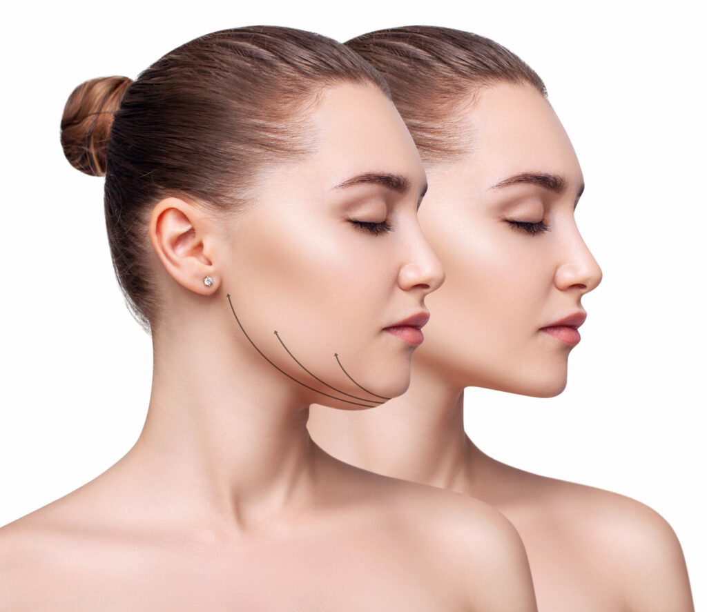 Skin Tightening Treatment in Delhi