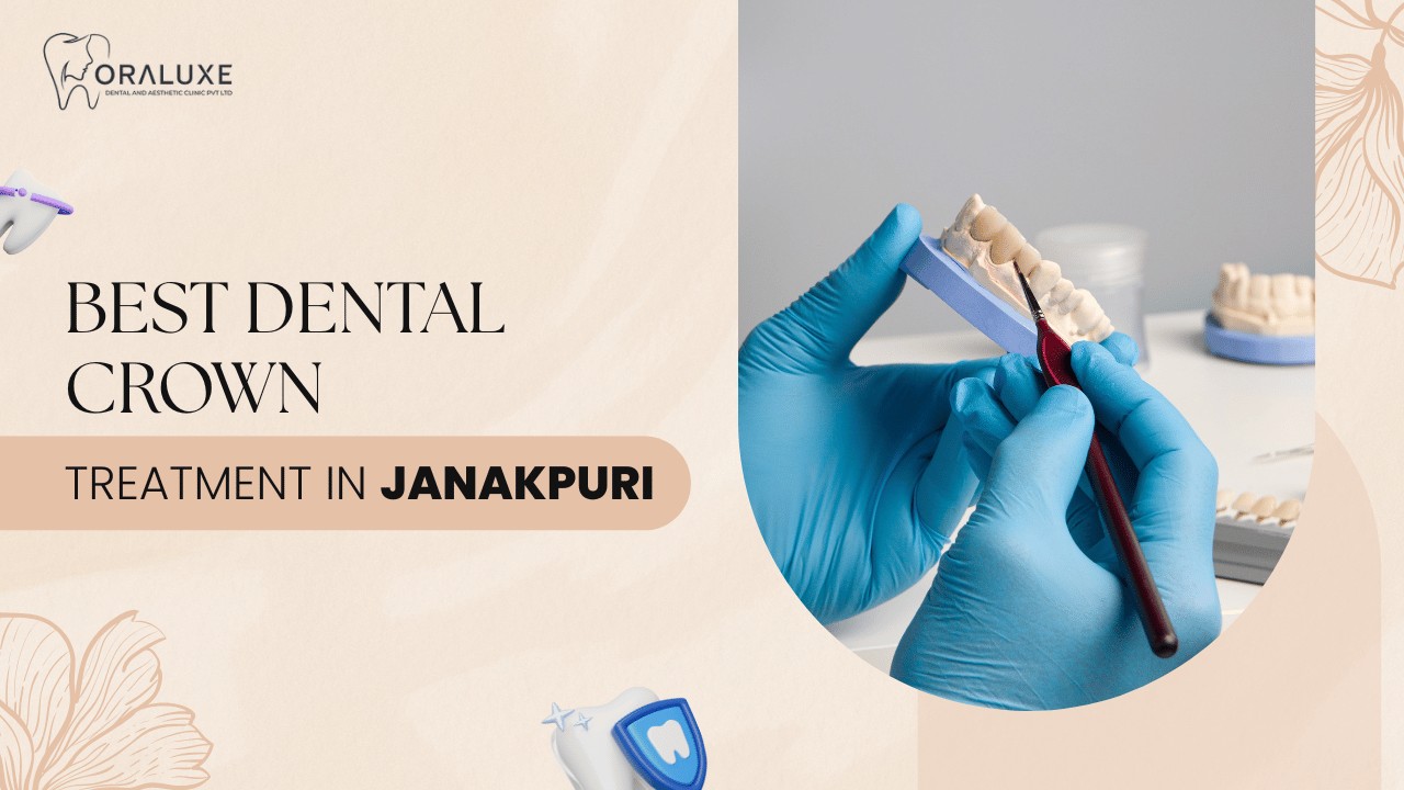 Best Dental Crown Treatment in Janakpuri