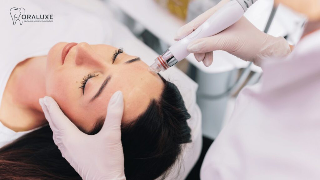 Best HydraFacial Treatment in Janakpuri