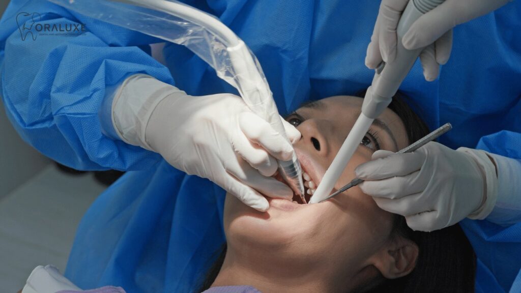 Painless Root Canal Treatment in Janakpuri