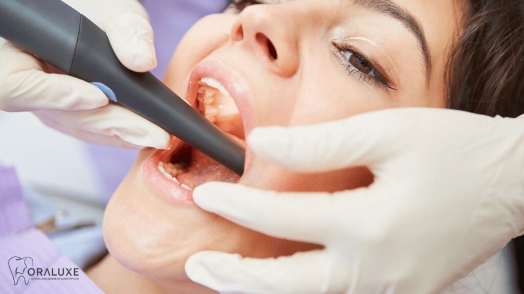 Painless Root Canal Treatment in Janakpuri