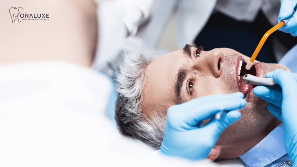 Painless Root Canal Treatment in Janakpuri