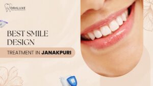 Smile Design Treatment in Janakpuri