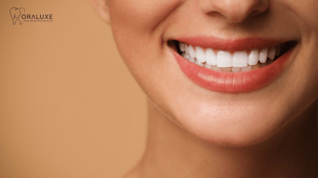 Best Smile Design Treatment in Janakpuri