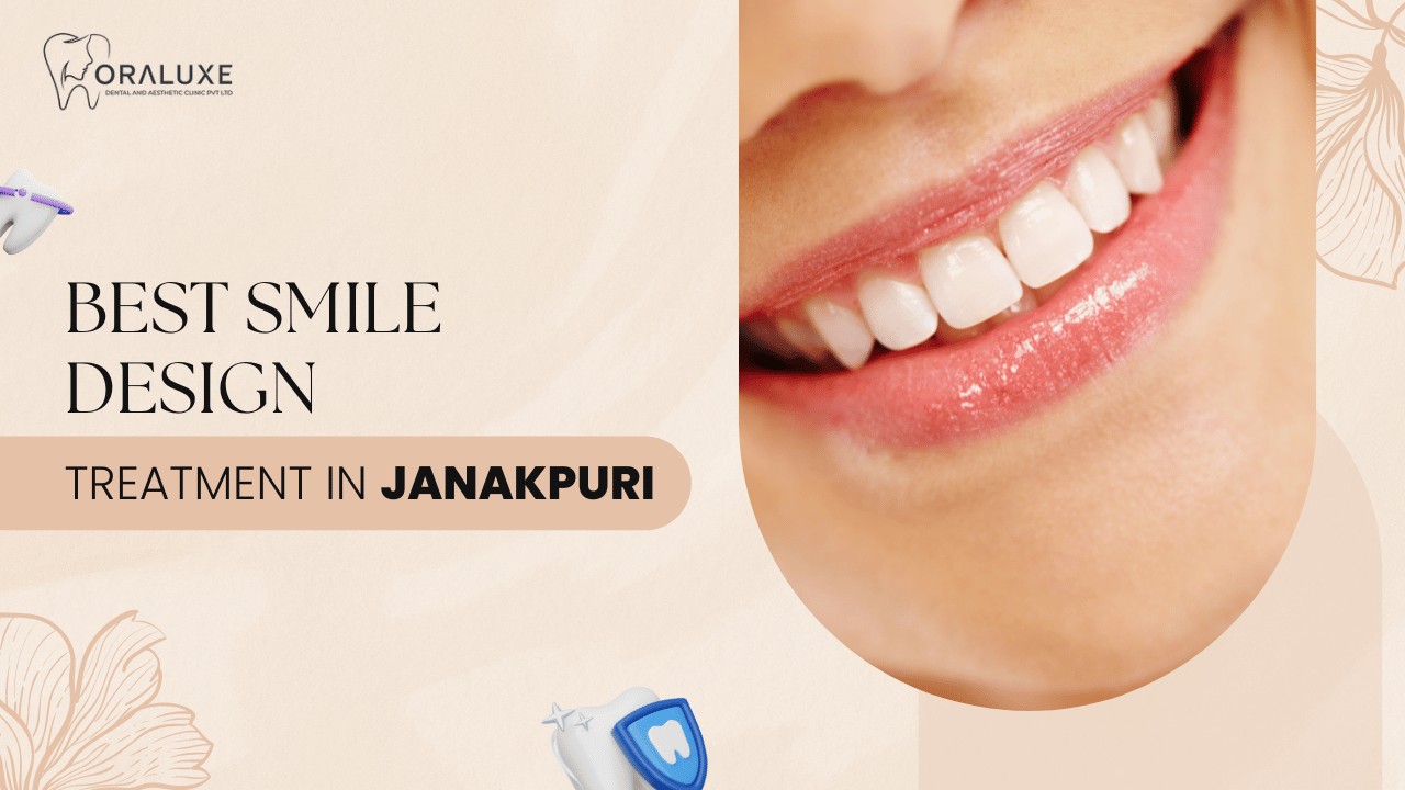Smile Design Treatment in Janakpuri