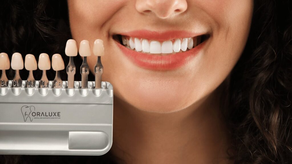 Best Dental Crown Treatment in Janakpuri