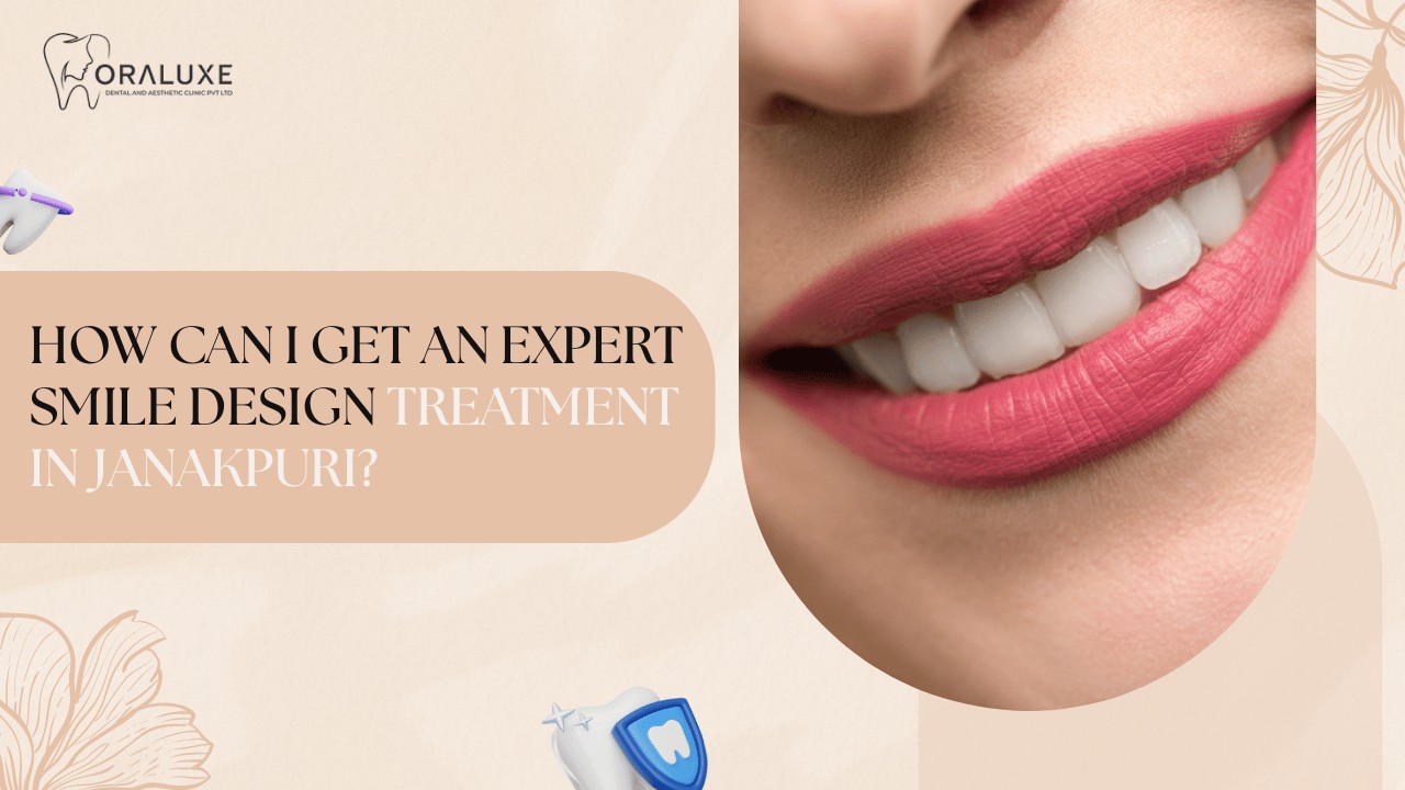 Smile Design Treatment in Janakpuri