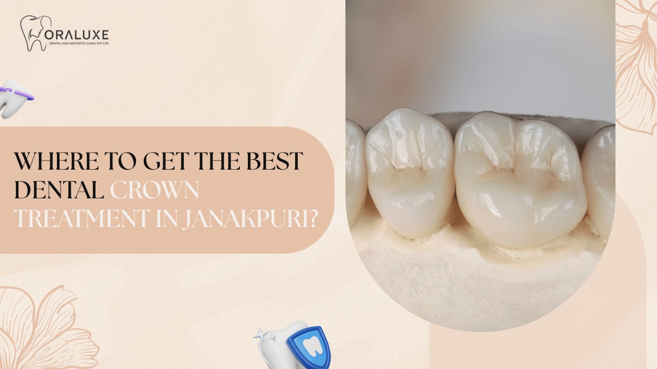 Dental Crown Treatment in Janakpuri