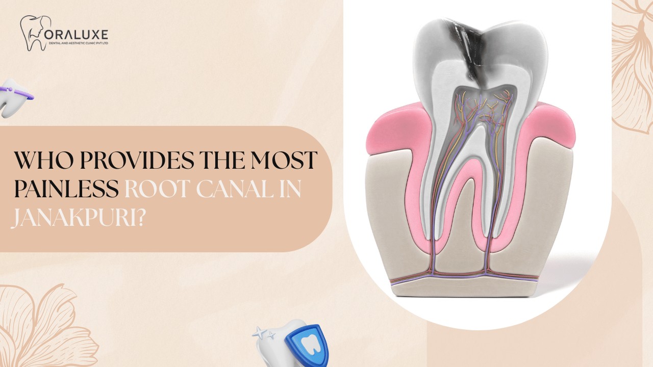 Painless Root Canal Treatment in Janakpuri