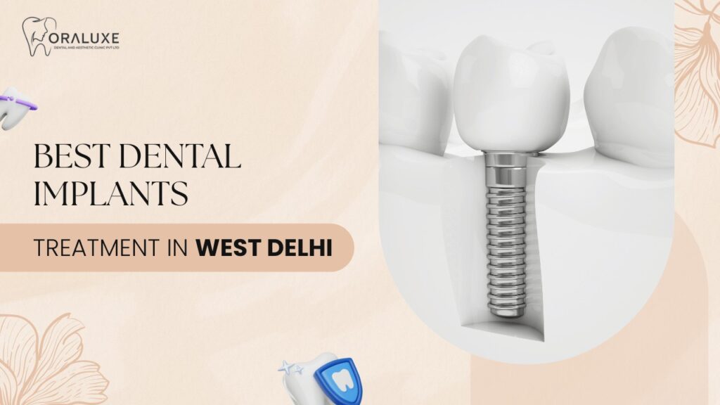Dental Implants Treatment in West Delhi