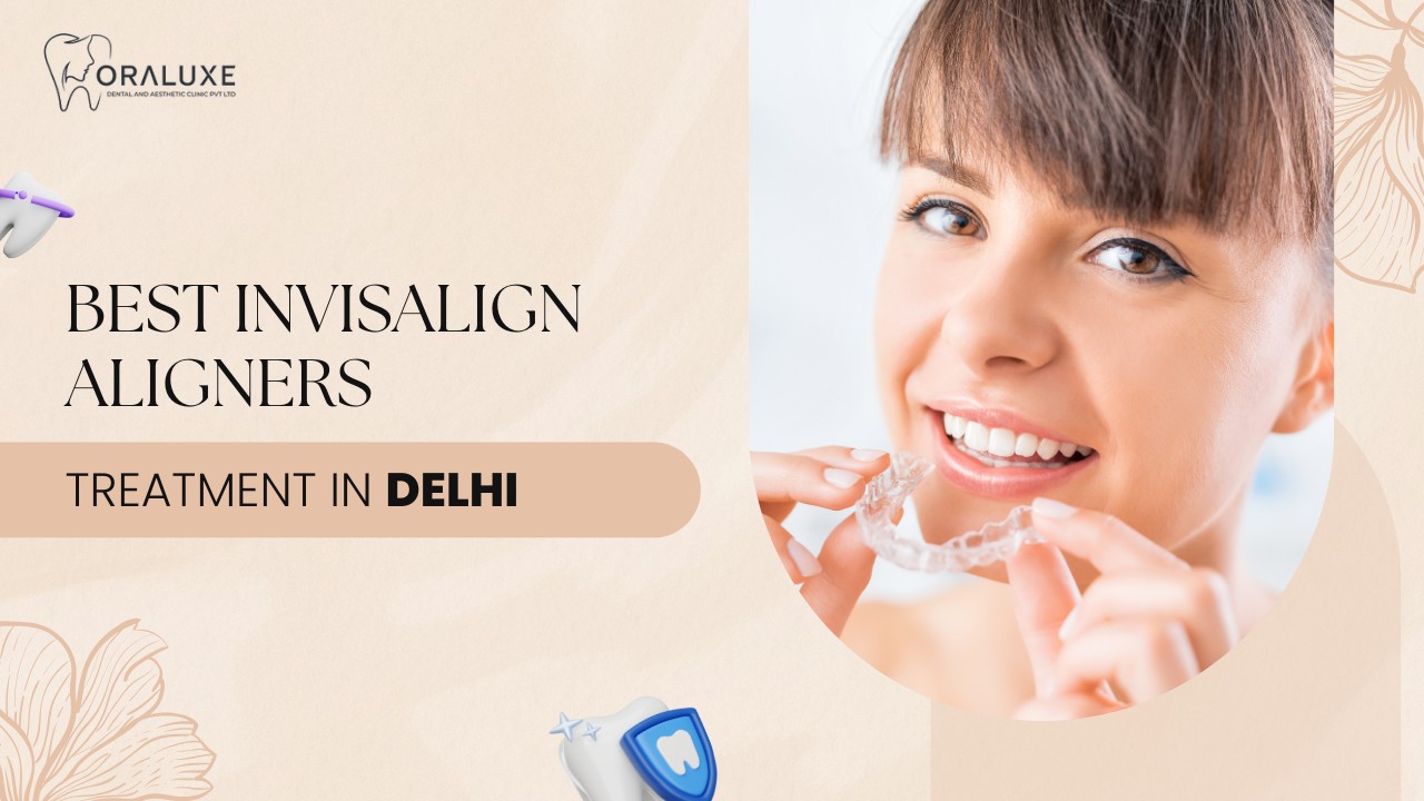 Invisalign Aligners Treatment in Delhi