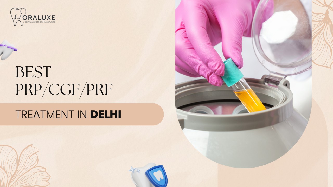 Best PRP/CGF/PRF Treatment in Delhi