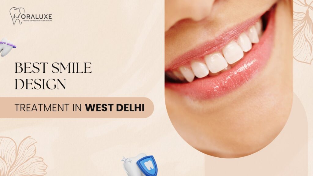 Smile Design Treatment in West Delhi