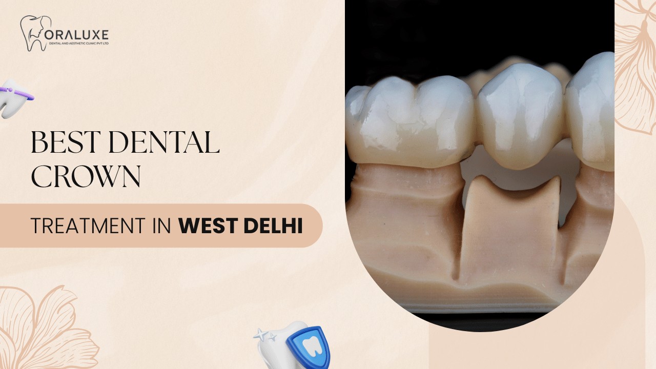 Dental Crown Treatment