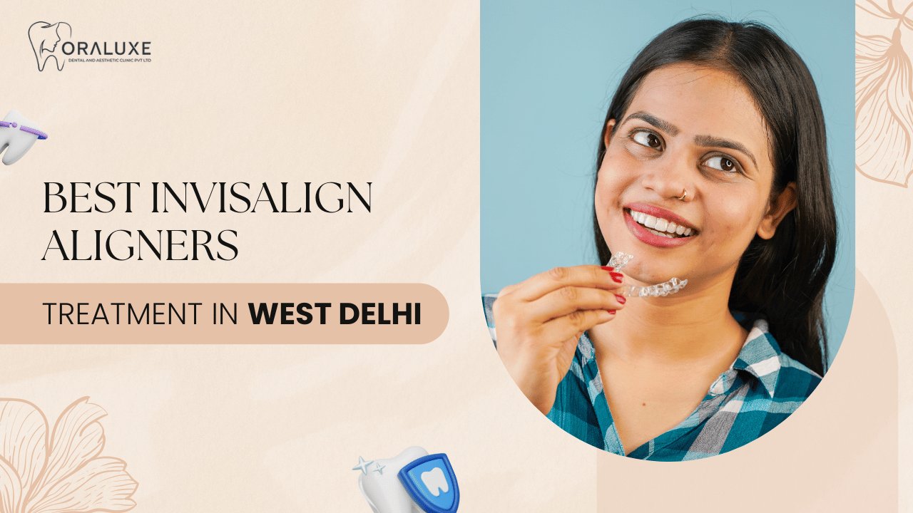 Best Invisalign Aligners Treatment in West Delhi