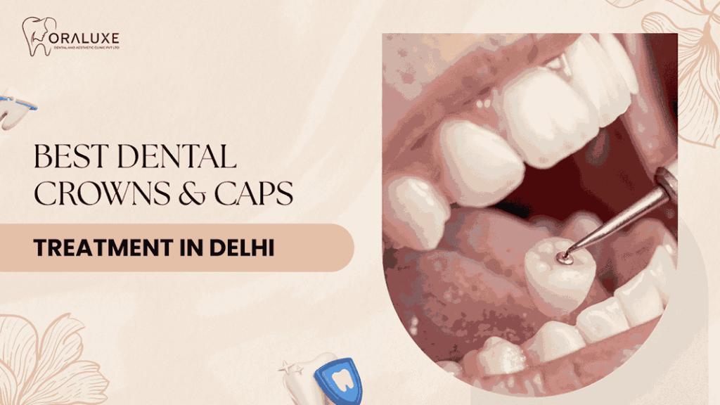 Dental Crown Treatment in Delhi