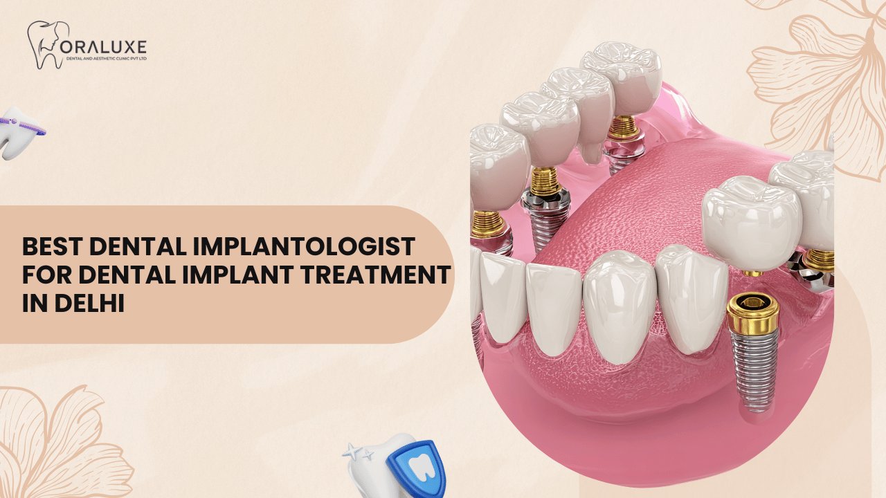 Dental Implants Treatment in Delhi