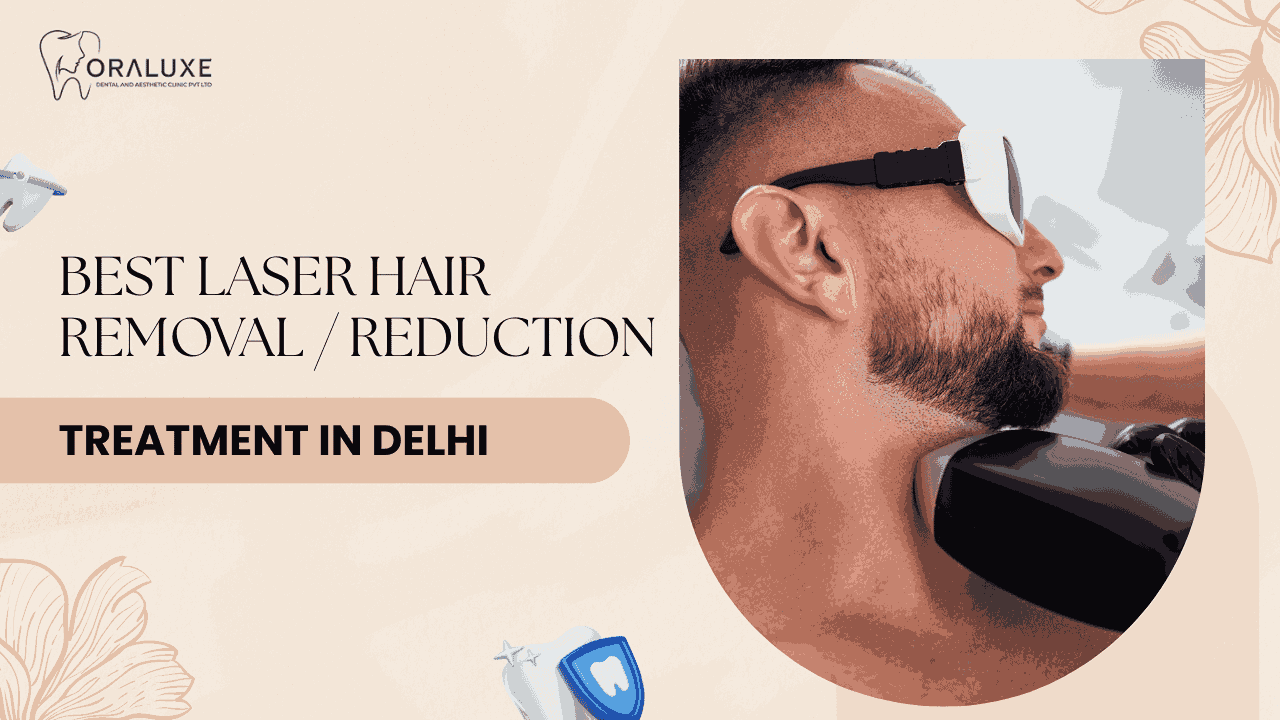 Laser Hair Removal Treatment in Delhi