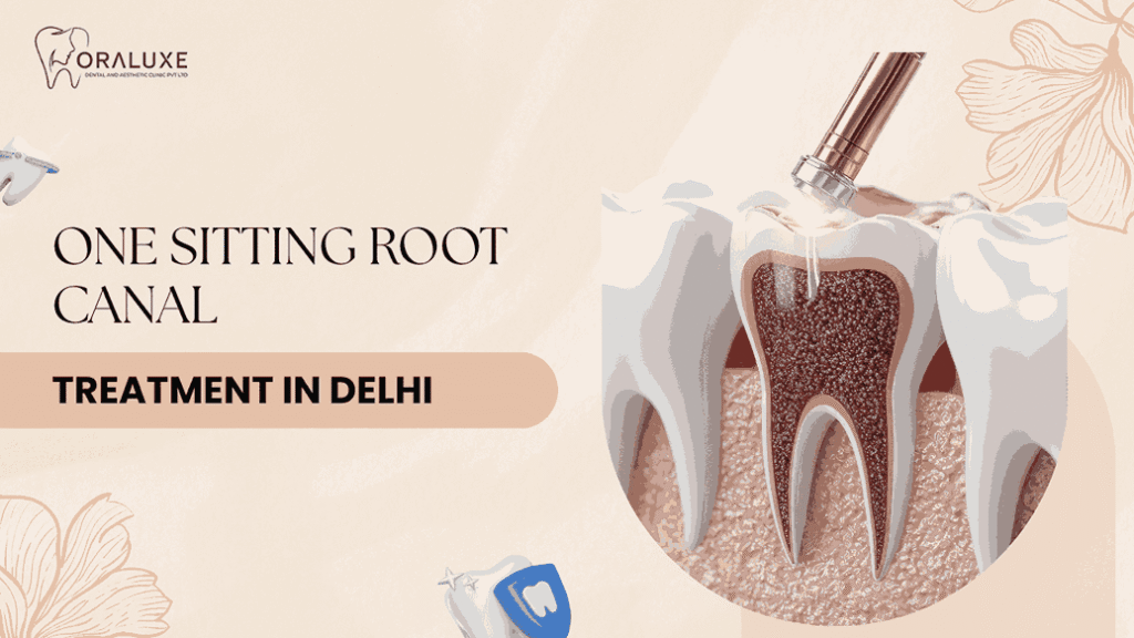Painless Root Canal Treatment in Delhi