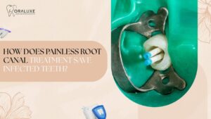 Painless Root Canal Treatment in Delhi