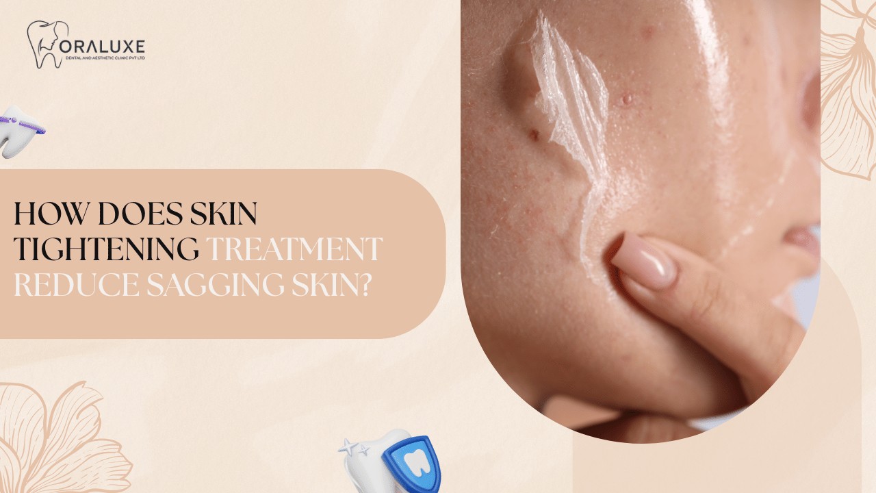 Skin Tightening Treatment in Delhi