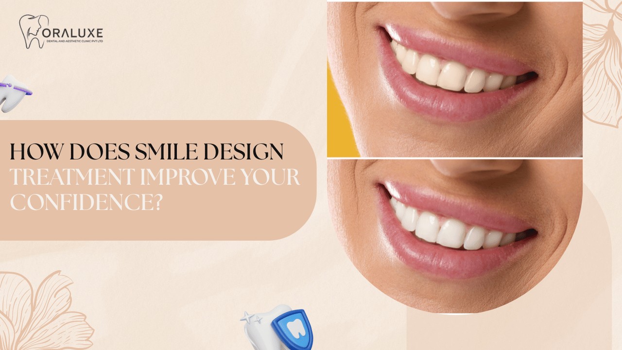 Smile Design Treatment in Delhi