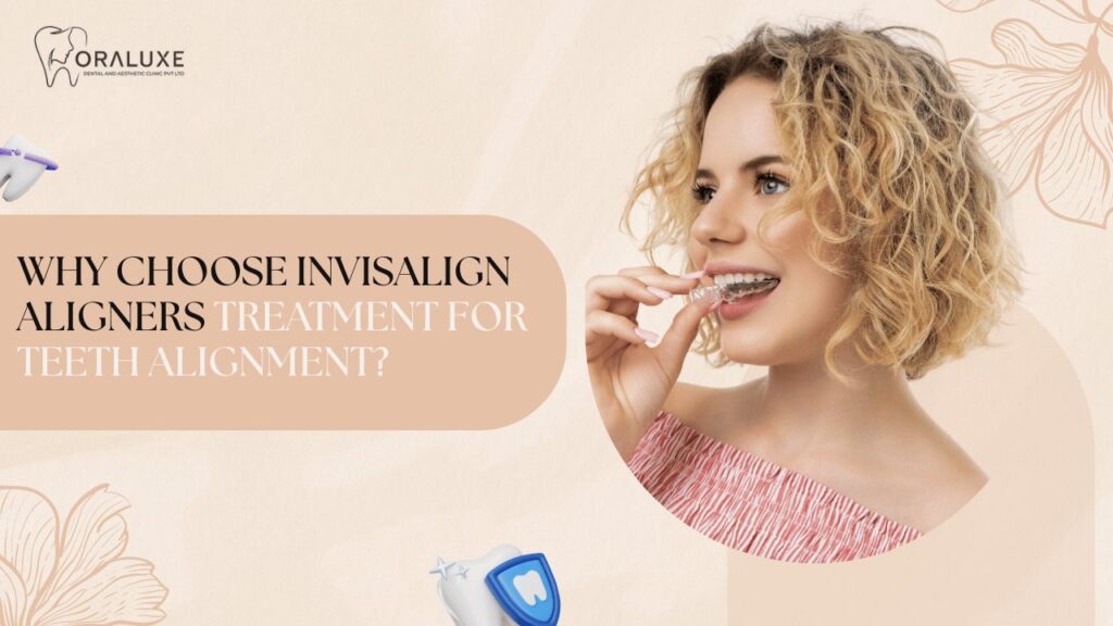 Invisalign Aligners Treatment in Delhi