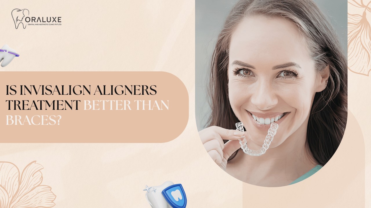 Invisalign Aligners Treatment in Delhi