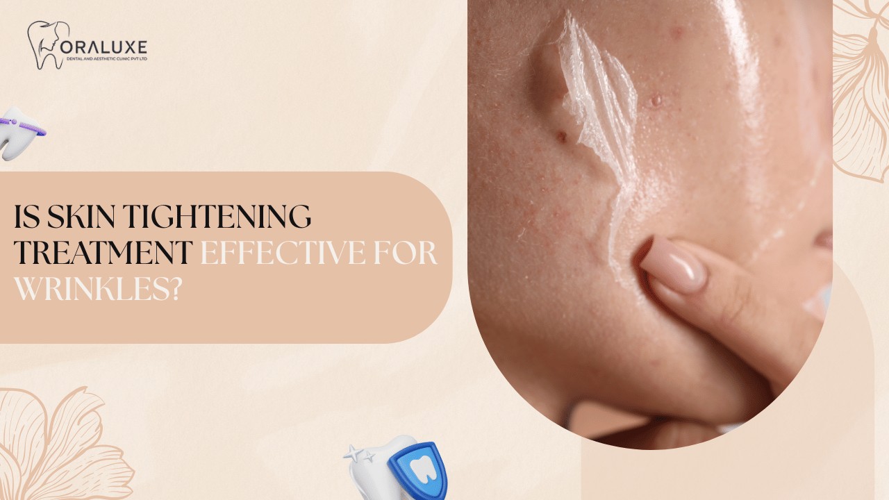 Skin Tightening Treatment in Delhi