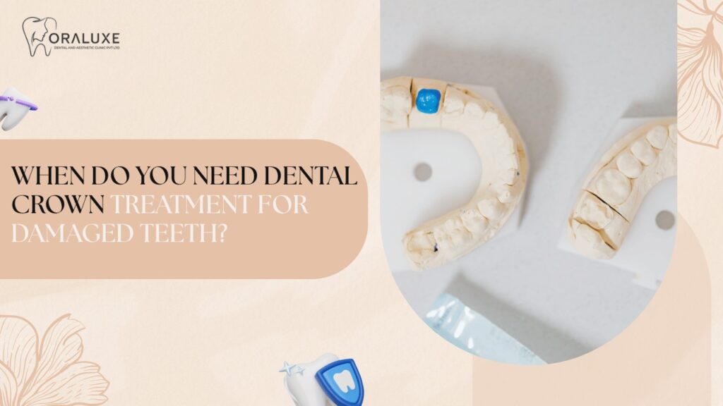 Dental Crown Treatment