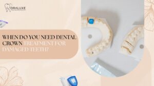 Dental Crown Treatment