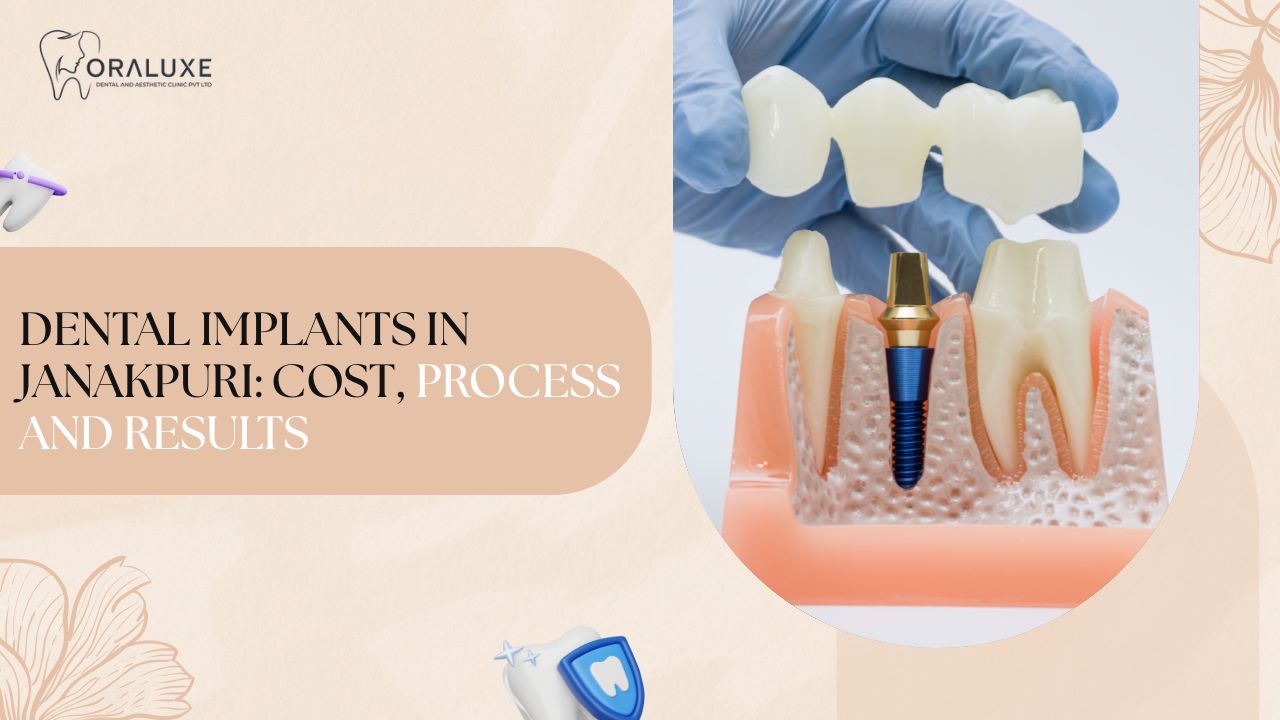 Dental implants in Janakpuri consultation at Oraluxe Clinic