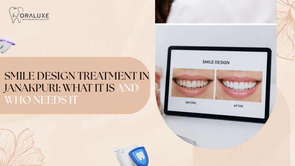 Smile design treatment in Janakpuri at Oraluxe Clinic
