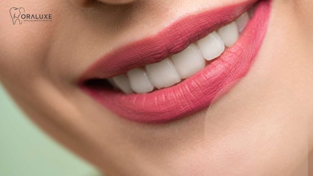 Digital treatment planning for smile design with whitening, veneers, crowns and orthodontics
