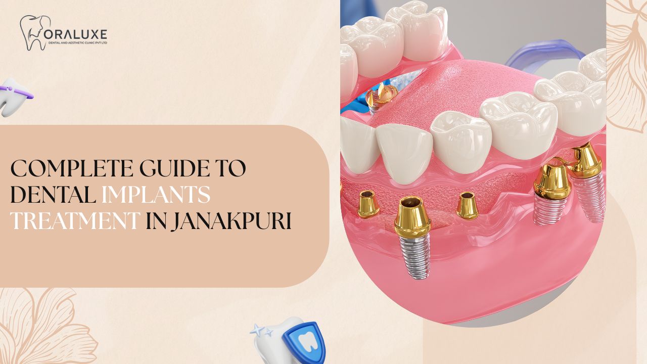Dental implant consultation at Oraluxe in Janakpuri