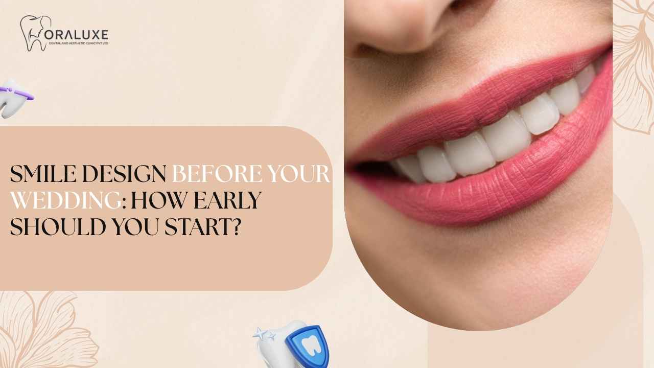 Bridal smile design consultation at Oraluxe Clinic in Janakpuri