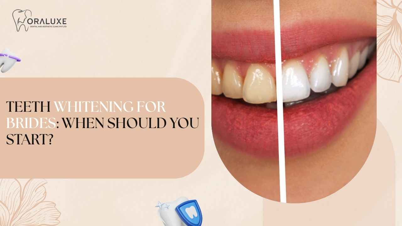 Bridal teeth whitening consultation at Oraluxe in Janakpuri